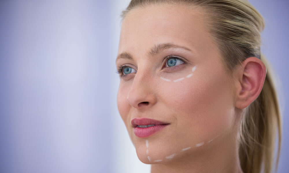 Cedial - Descubre la Transformación Natural con Nuestro Lifting Facial sin Cirugía